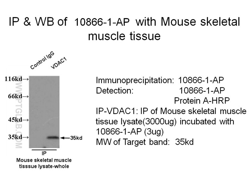 VDAC1 IP 10866-1-AP VDAC1 Antibody MGC111064; PORIN; PORIN-31-HL