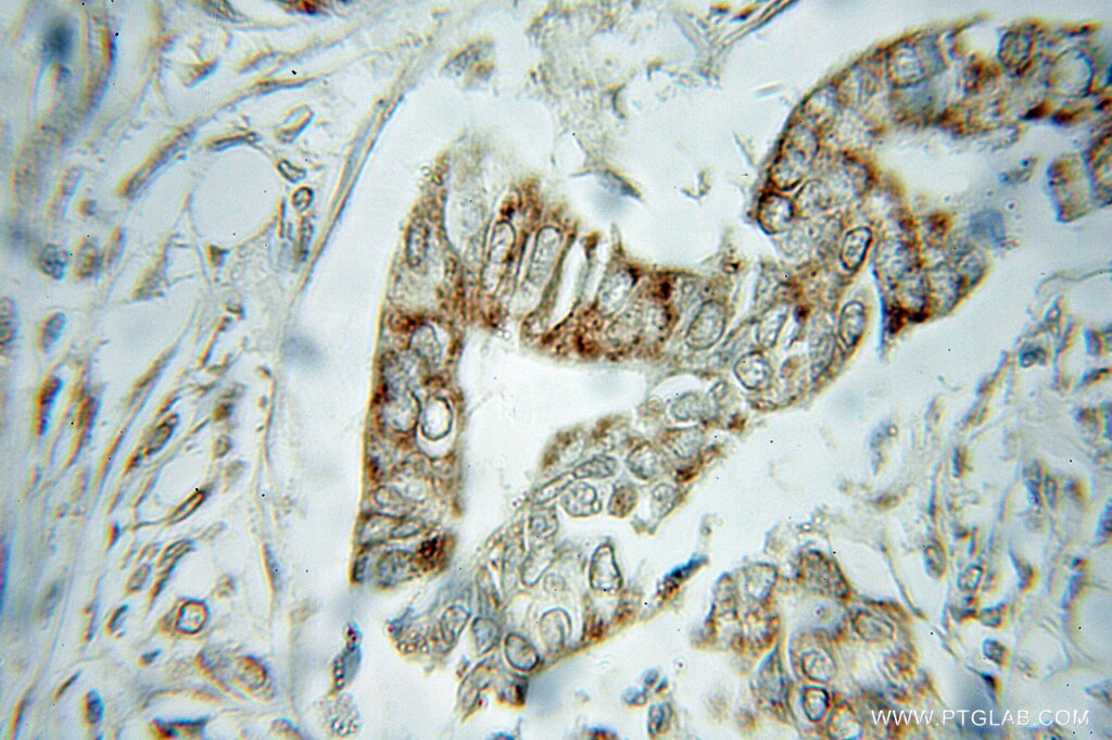 VDAC1 IHC Immunohistochemical 10866-1-AP VDAC1 Antibody MGC111064; PORIN; PORIN-31-HL
