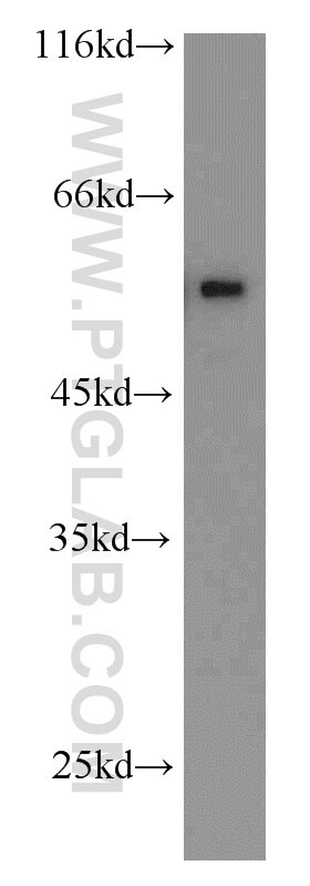 VIM western blot WB 10366-1-AP VIM Antibody FLJ36605