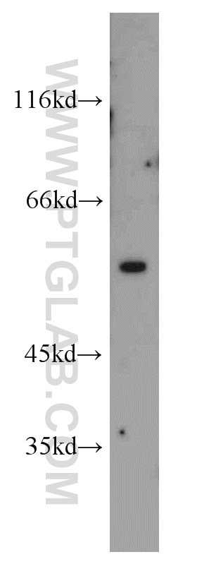 HEK-293 cells were subjected to SDS PAGE followed by western blot with 22031-1-AP(VIM Antibody) at dilution of 1:1000 VIM western blot WB 22031-1-AP VIM Antibody FLJ36605