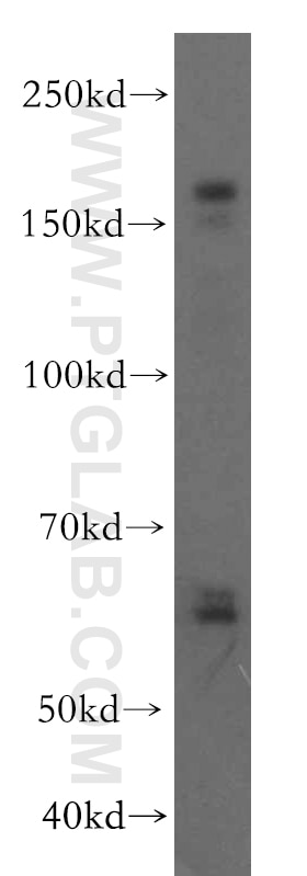 VLDLR western blot WB 19493-1-AP VLDLR Antibody CHRMQ1; FLJ35024; VLDLRCH