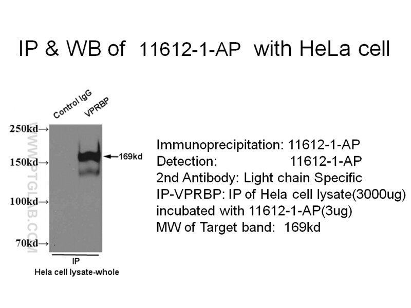 VPRBP IP 11612-1-AP VPRBP Antibody DCAF1; KIAA0800; MGC102804