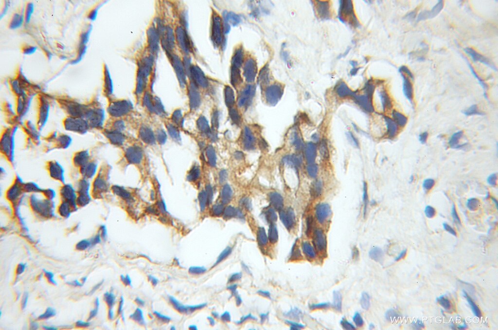 VPRBP IHC Immunohistochemical 11612-1-AP VPRBP Antibody DCAF1; KIAA0800; MGC102804