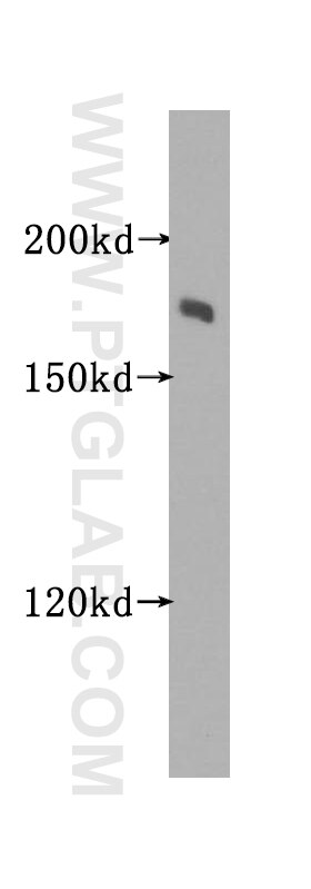 VPRBP western blot WB 11612-1-AP VPRBP Antibody DCAF1; KIAA0800; MGC102804