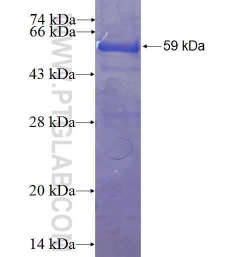 VPS33B fusion protein ag2833 SDS-PAGE