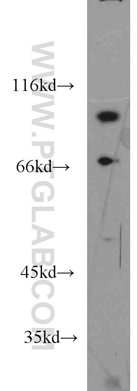 HepG2 cells were subjected to SDS PAGE followed by western blot with 13869-1-AP(VPS41 Antibody) at dilution of 1:400 VPS41 western blot WB 13869-1-AP VPS41 Antibody HVPS41; HVSP41; hVps41p