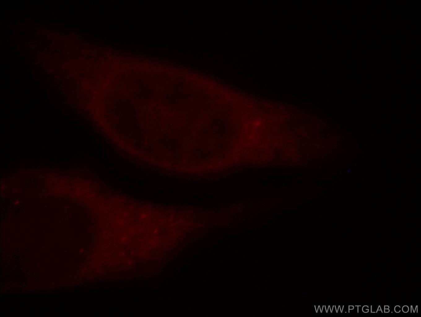 Immunofluorescent analysis of HepG2 cells, using VPS8 antibody 15079-1-AP at 1:25 dilution and Rhodamine-labeled goat anti-rabbit IgG (red). VPS8 Immunofluorescence IF 15079-1-AP VPS8 Antibody FLJ32099; KIAA0804