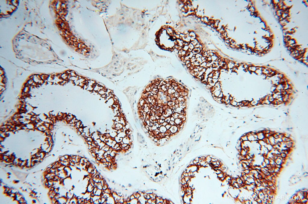VSIG1 IHC Immunohistochemical 14145-1-AP VSIG1 Antibody 1700062D20Rik; GPA34; MGC44287; dJ889N15.1
