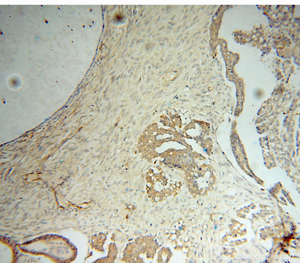 WARS IHC Immunohistochemical 16081-1-AP WARS Antibody GAMMA-2; IFI53; IFP53