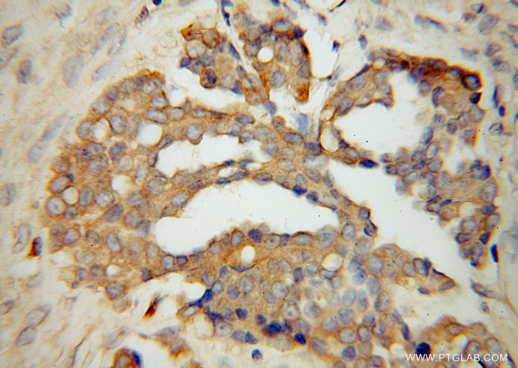 WARS IHC Immunohistochemical 16081-1-AP WARS Antibody GAMMA-2; IFI53; IFP53