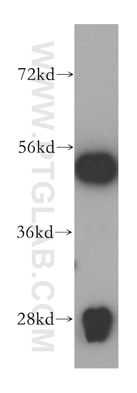 WARS western blot WB 16081-1-AP WARS Antibody GAMMA-2; IFI53; IFP53