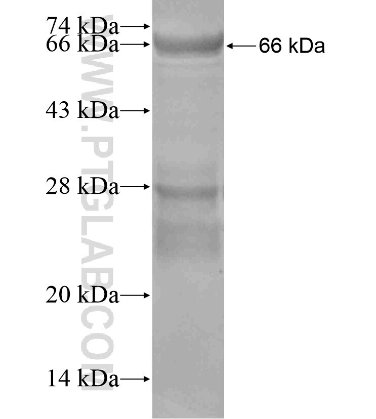 WNK4 fusion protein ag17773 SDS-PAGE