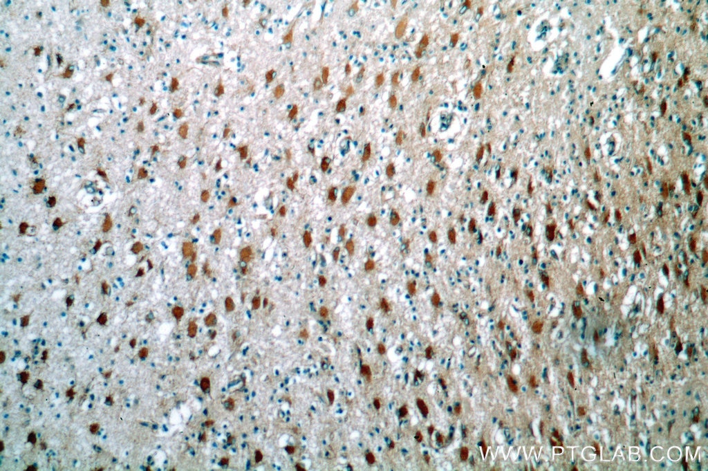 WNT2 IHC Immunohistochemical 11160-1-AP WNT2 Antibody INT1L1; IRP