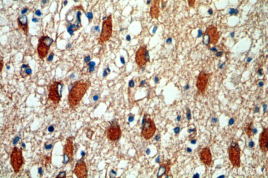 WNT2 IHC Immunohistochemical 11160-1-AP WNT2 Antibody INT1L1; IRP