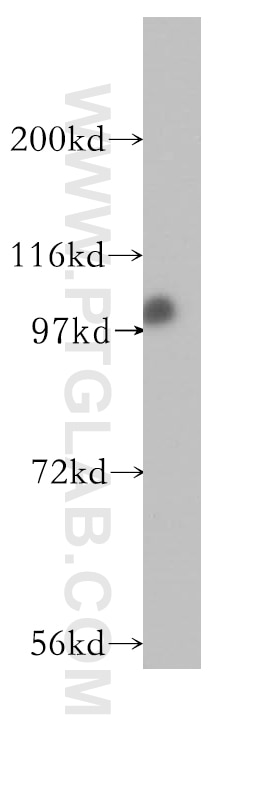 K-562 cells were subjected to SDS PAGE followed by western blot with 10637-1-AP(XAB2 Antibody) at dilution of 1:200 XAB2 western blot WB 10637-1-AP XAB2 Antibody DKFZp762C1015; HCNP; HCRN; NTC90; SYF1