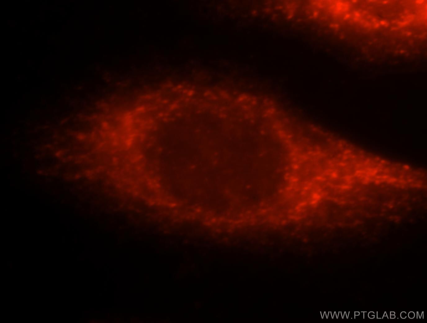XIAP Immunofluorescence IF 10037-1-Ig XIAP Antibody API3; BIRC4; ILP1; MIHA; XLP2