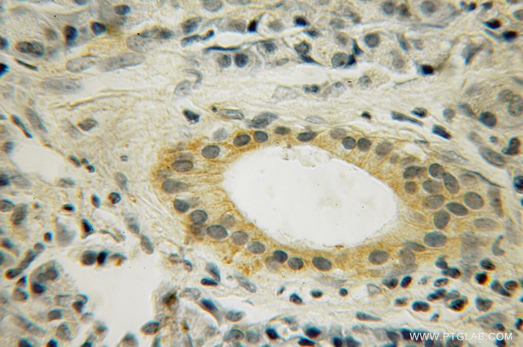 XK IHC Immunohistochemical 12830-1-AP XK Antibody KX; X1k; XKR1