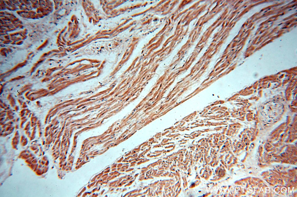 XPO1 IHC Immunohistochemical 12915-1-AP XPO1 Antibody CRM1; DKFZp686B1823