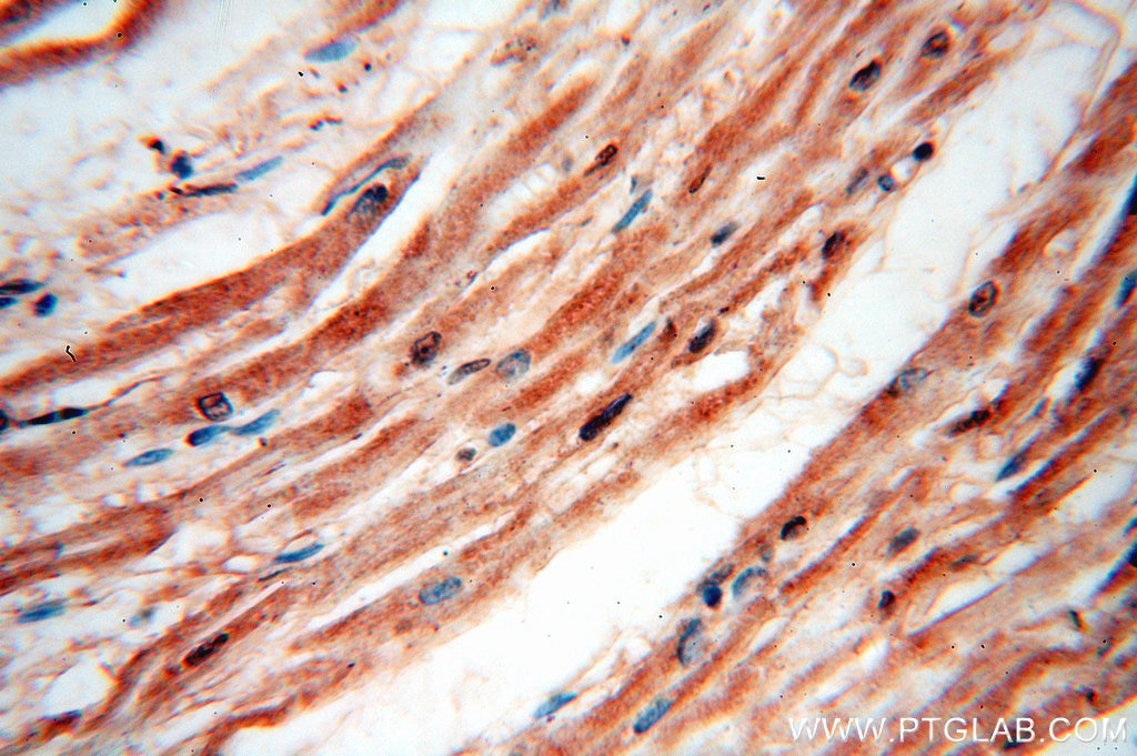 XPO1 IHC Immunohistochemical 12915-1-AP XPO1 Antibody CRM1; DKFZp686B1823