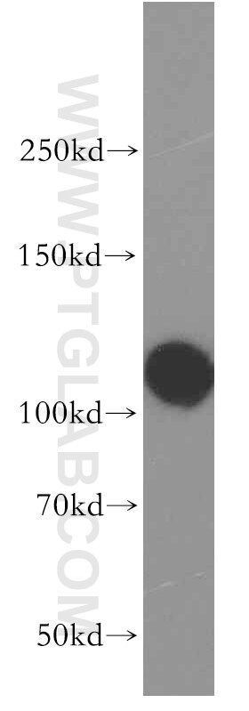 XPO1 western blot WB 12915-1-AP XPO1 Antibody CRM1; DKFZp686B1823