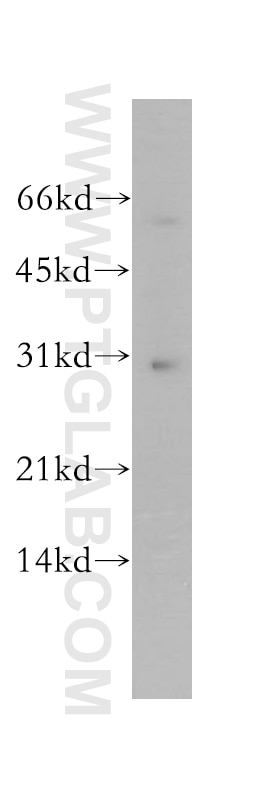 human liver tissue were subjected to SDS PAGE followed by western blot with 12931-1-AP(YIPF5 Antibody) at dilution of 1:800 YIPF5 western blot WB 12931-1-AP YIPF5 Antibody DKFZp313L2216; FinGER5; SB140; SMAP-5; SMAP5; YIP1A