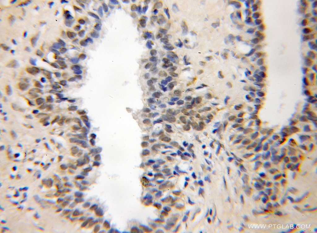 YPEL5 IHC Immunohistochemical 11730-1-AP YPEL5 Antibody CGI-127