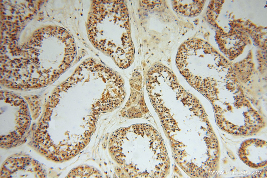 HIP14; ZDHHC17 IHC Immunohistochemical 15465-1-AP HIP14; ZDHHC17 Antibody HIP14; HIP3; HSPC294; HYPH; KIAA0946