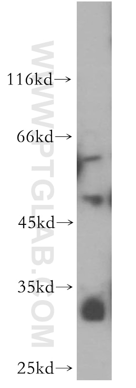 HL-60 cells were subjected to SDS PAGE followed by western blot with 19005-1-AP(ZFP36L2 Antibody) at dilution of 1:600 ZFP36L2 western blot WB 19005-1-AP ZFP36L2 Antibody BRF2; ERF-2; ERF2; RNF162C; TIS11D