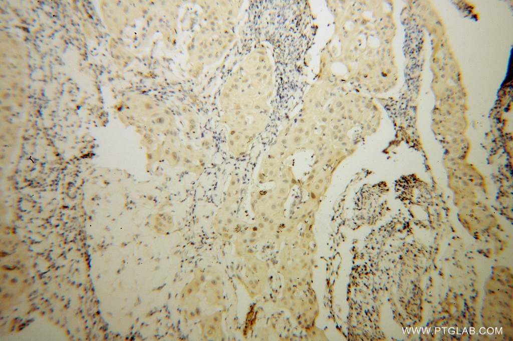 ZHX1 IHC Immunohistochemical 13903-1-AP ZHX1 Antibody 