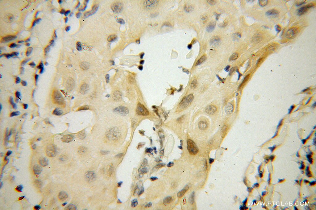 ZHX1 IHC Immunohistochemical 13903-1-AP ZHX1 Antibody 