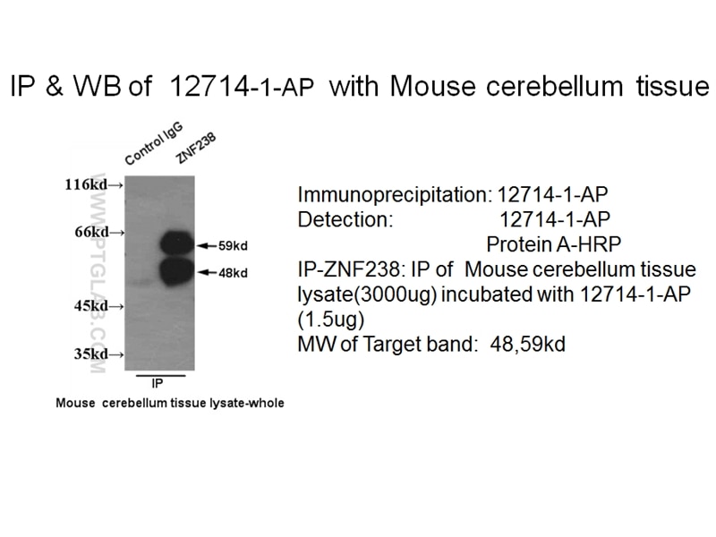 ZNF238 IP 12714-1-AP ZNF238 Antibody C2H2-171; RP58; TAZ-1; ZBTB18