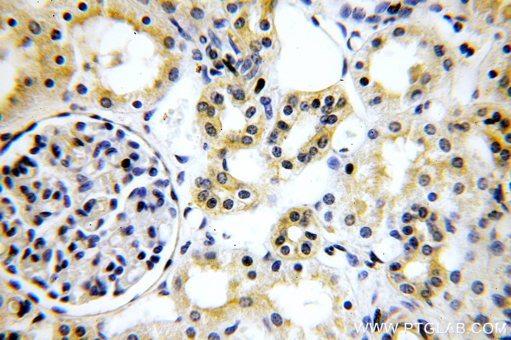 ptglab-zo-1-antibody-21773-1-ap