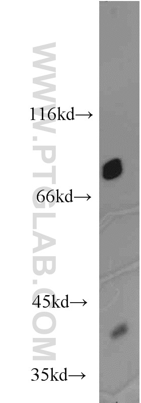 HeLa cells were subjected to SDS PAGE followed by western blot with 10330-1-AP(ZYX Antibody) at dilution of 1:800 ZYX western blot WB 10330-1-AP ZYX Antibody ESP-2; HED-2