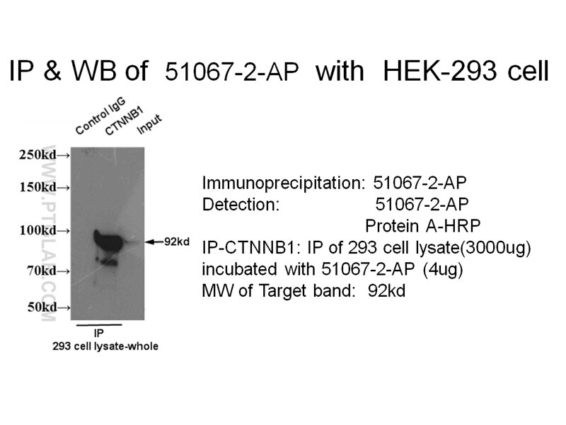 b-cat IP 51067-2-AP b-cat Antibody CTNNB; DKFZp686D02253; FLJ25606; FLJ37923