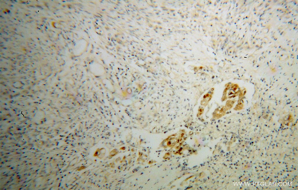 b-cat IHC Immunohistochemical 51067-2-AP b-cat Antibody CTNNB; DKFZp686D02253; FLJ25606; FLJ37923