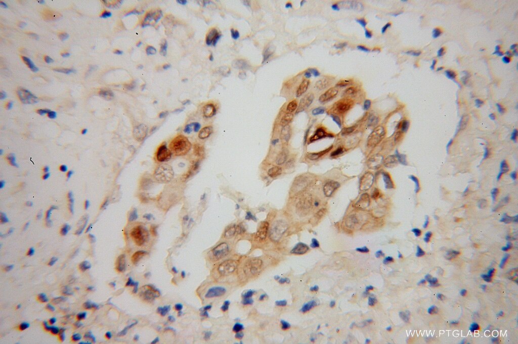 b-cat IHC Immunohistochemical 51067-2-AP b-cat Antibody CTNNB; DKFZp686D02253; FLJ25606; FLJ37923