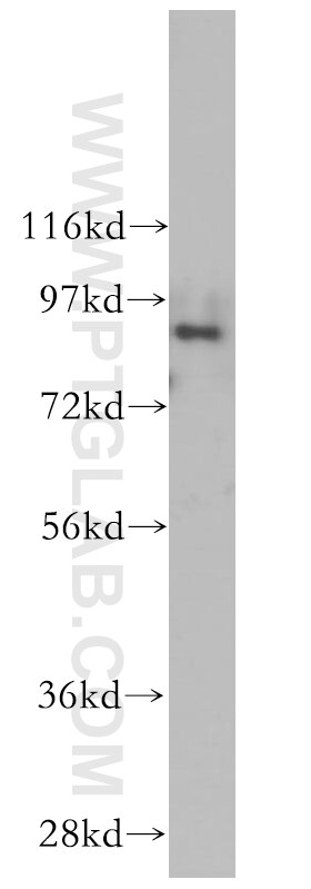 b-cat western blot WB 51067-2-AP b-cat Antibody CTNNB; DKFZp686D02253; FLJ25606; FLJ37923