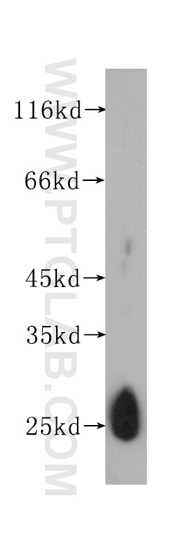 Recombinant protein were subjected to SDS PAGE followed by western blot with 60158-1-Ig(dNGLUC Antibody) at dilution of 1:1500 dNGLUC western blot WB 60158-1-Ig dNGLUC Antibody