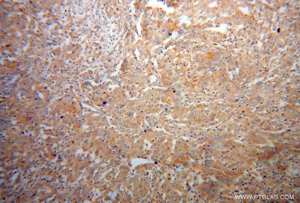 p70(S6K) IHC Immunohistochemical 14485-1-AP p70(S6K) Antibody PS6K; S6K; S6K1; STK14A; p70(S6K)-alpha; p70-S6K; p70-alpha