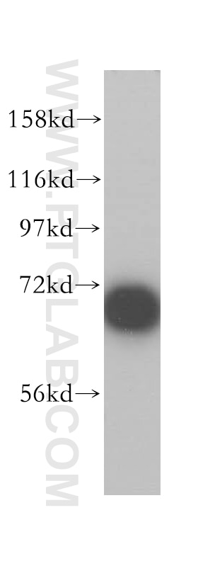 p70(S6K) western blot WB 14485-1-AP p70(S6K) Antibody PS6K; S6K; S6K1; STK14A; p70(S6K)-alpha; p70-S6K; p70-alpha