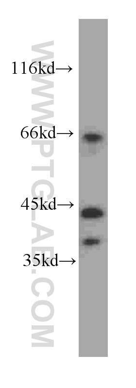 Phospho-Akt (Tyr315) western blot WB 60072-1-Ig Phospho-Akt (Tyr315) Antibody AKT; MGC99656; PKB; PKB-ALPHA; PRKBA; RAC; RAC-ALPHA