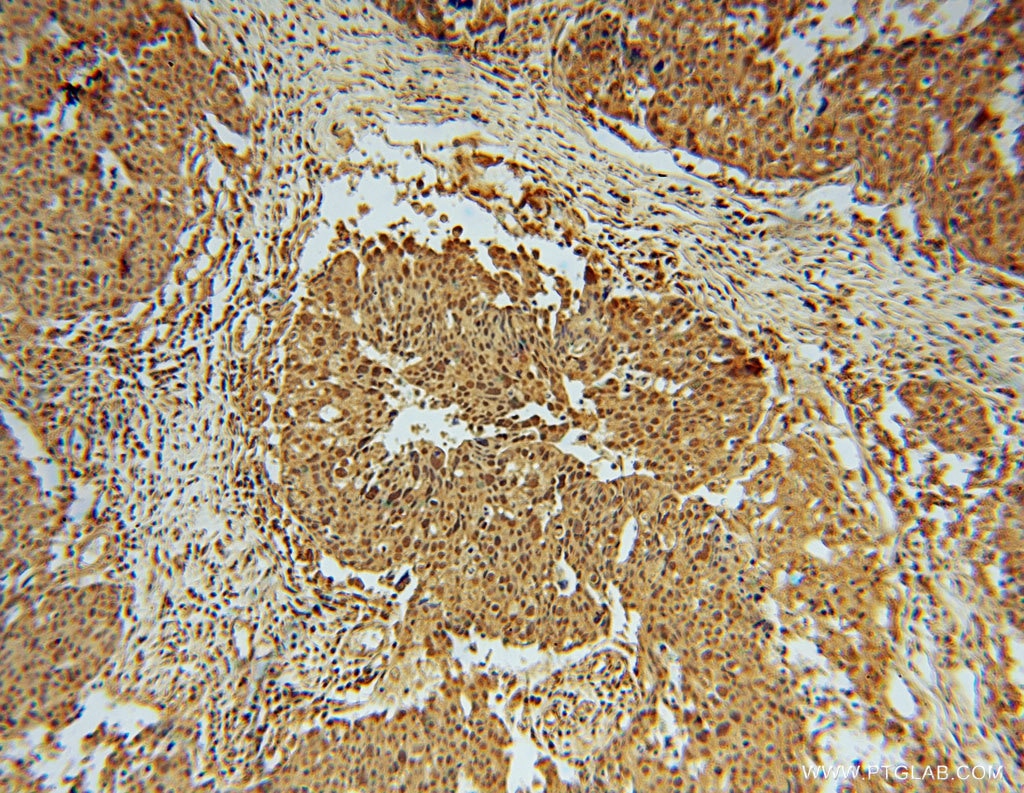 phospho-CHC1(Ser12) IHC Immunohistochemical 14444-1-AP phospho-CHC1(Ser12) Antibody CHC1; RCC1-I