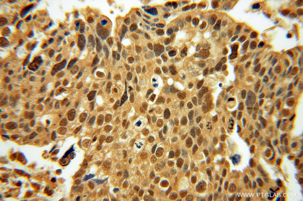 phospho-CHC1(Ser12) IHC Immunohistochemical 14444-1-AP phospho-CHC1(Ser12) Antibody CHC1; RCC1-I