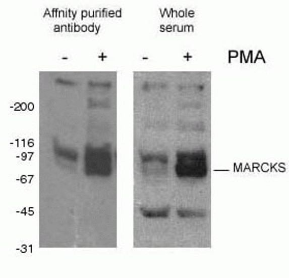 phospho-Marcks western blot WB 10018-3-AP phospho-Marcks Antibody Macs; PKCSL
