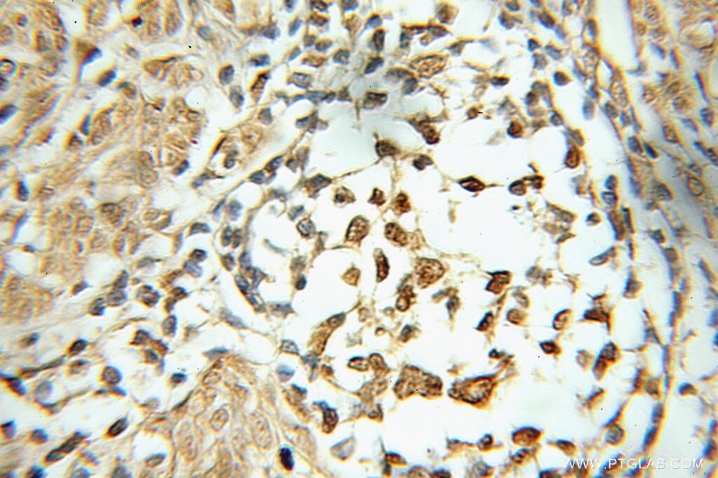 ubiquitin IHC Immunohistochemical 10201-2-AP ubiquitin Antibody FLJ25987; MGC8385