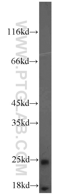 ubiquitin western blot WB 10201-2-AP ubiquitin Antibody FLJ25987; MGC8385
