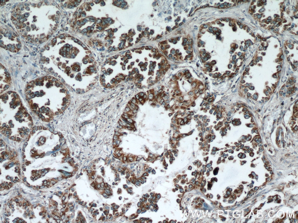 REDD1 IHC Immunohistochemical 10638-1-AP REDD1 Antibody Dig2; FLJ20500; REDD-1; REDD1; RP11-442H21.1; RTP801