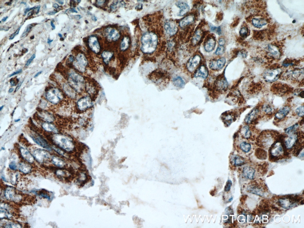 REDD1 IHC Immunohistochemical 10638-1-AP REDD1 Antibody Dig2; FLJ20500; REDD-1; REDD1; RP11-442H21.1; RTP801
