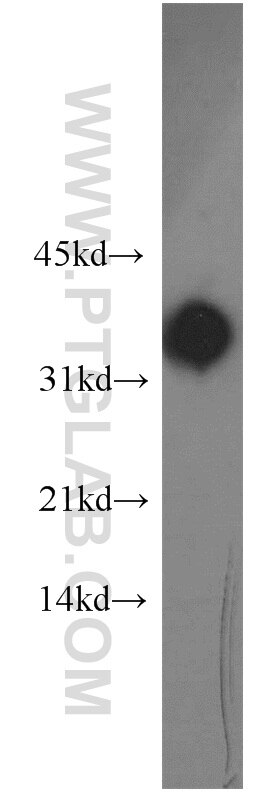 REDD1 western blot WB 10638-1-AP REDD1 Antibody Dig2; FLJ20500; REDD-1; REDD1; RP11-442H21.1; RTP801