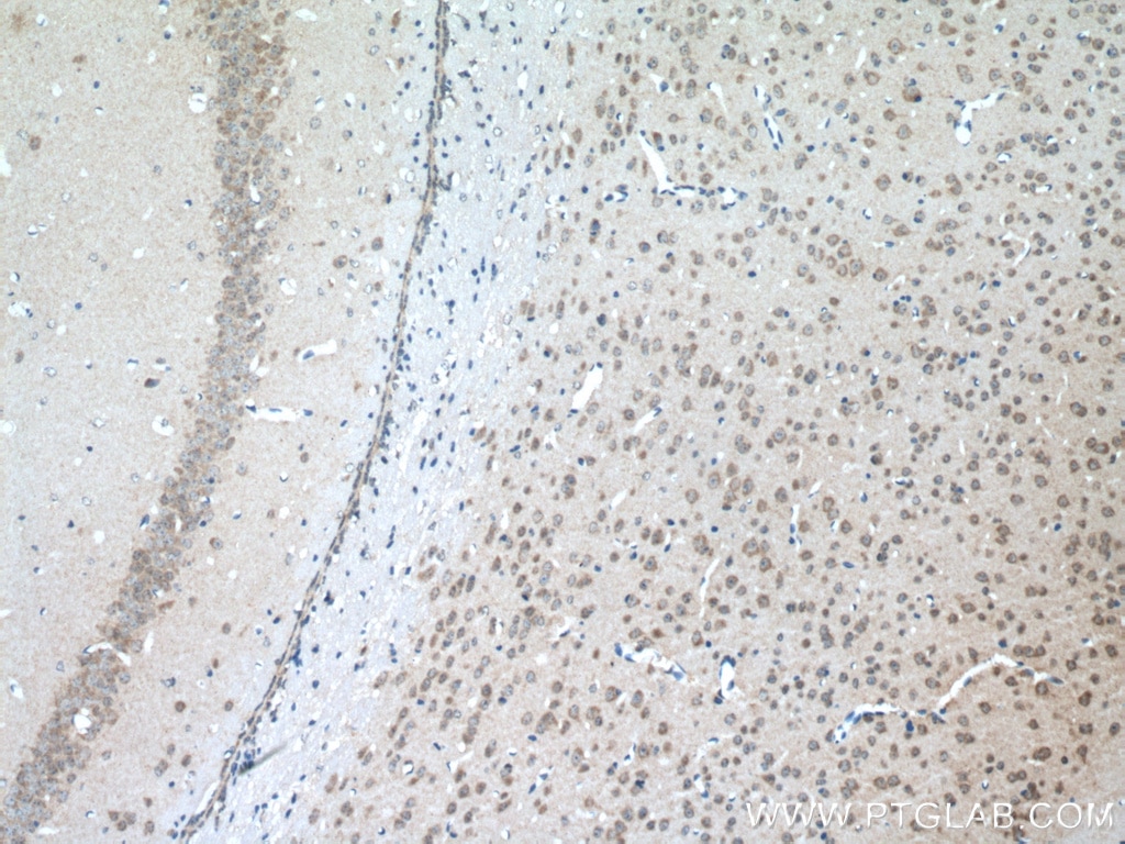 Immunohistochemical analysis of paraffin-embedded mouse brain tissue slide using 20507-1-AP (SLC11A2 antibody) at dilution of 1:200 (under 10x lens. Heat mediated antigen retrieval with Tris-EDTA buffer (pH 9.0).